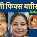 Best Dentist in Jaipur