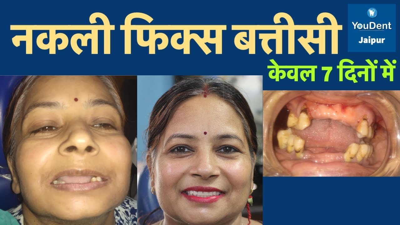 Best Dentist in Jaipur
